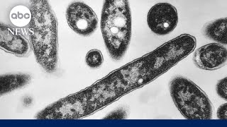 Download Lagu 2 dead and 58 sick from growing Legionnaires' disease cluster in New York City MP3 Download Lagu 2 dead and 58 sick from growing Legionnaires' disease cluster in New York City MP3