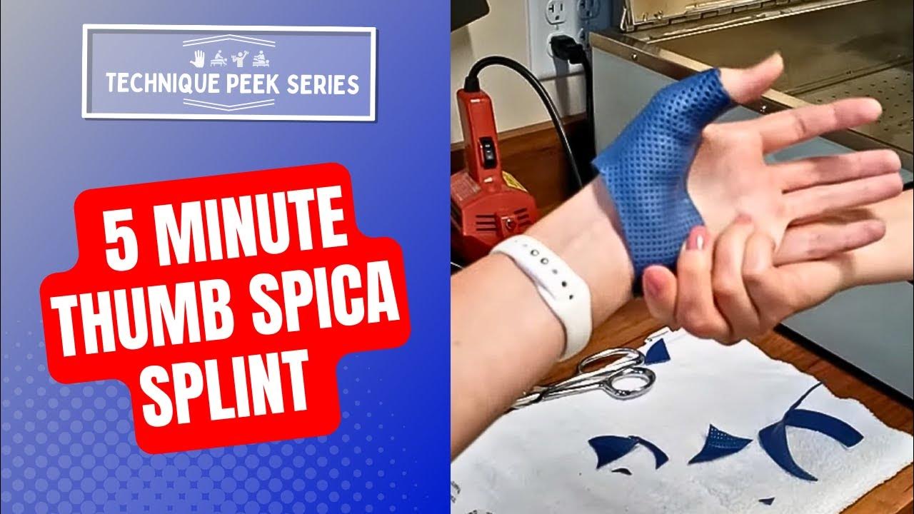 how-to-make-a-thumb-spica-splint-in-less-than-5-minutes