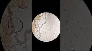 Sperm Motility :microscope view