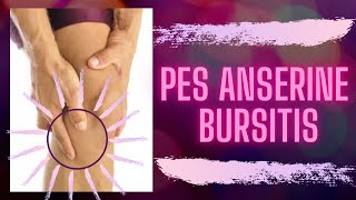 Pes Anserine Bursitis | Taping and Exercises for Effective Pain Relief | TriPhysio