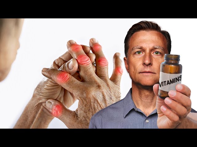 The #1 Best Vitamin for Arthritis (NOT VITAMIN D) class=