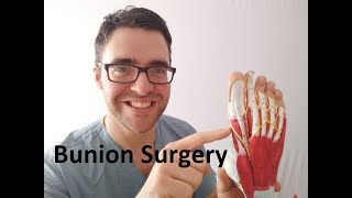 Bunion Surgery Recovery: *What to expect with bunionectomy surgery!*