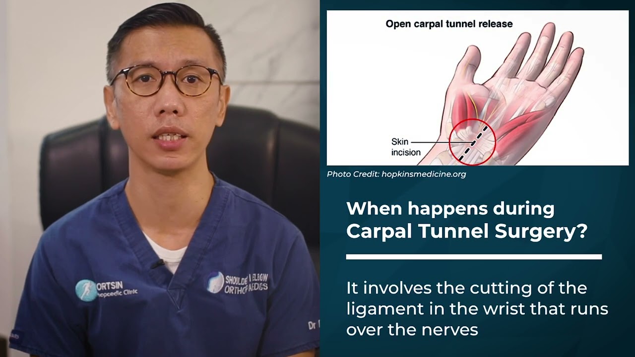 Carpal Tunney Syndrome With Dr Desmond Ong From Shoulder Elbow Orthopaedic Group