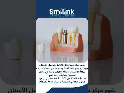 افضل مركز زراعة اسنان في المهندسين