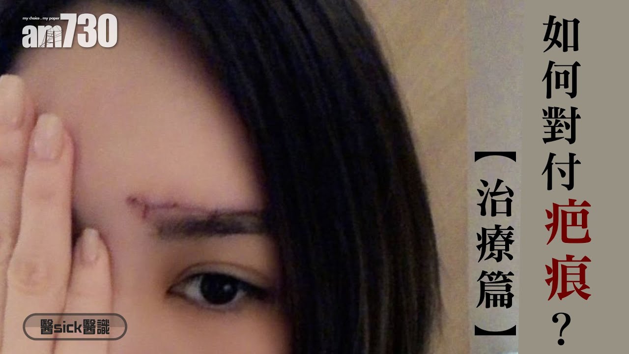 如何對付疤痕 治療篇 醫sick醫識 Am730