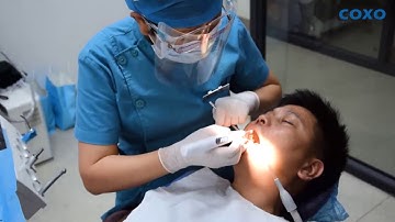 C-Fill Mini in clinic