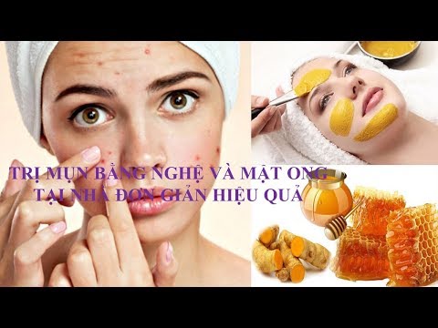 Cách Trị Mụn Bằng Nghệ và Mật Ong Tại Nhà Đơn Giản Hiệu Quả