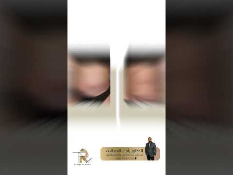 شفط الدهون و نحت الجسم و شد الترهلات