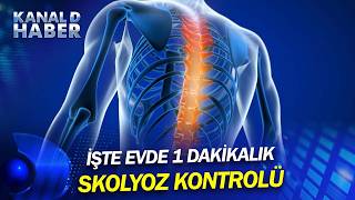 Sırttaki Sessiz Tehlike: Skolyoz! Anne Babalar Dikkat: Bu Testi Evde Yapabilirsiniz