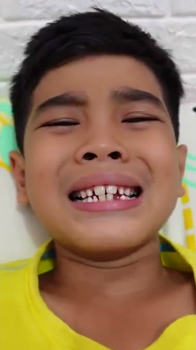 FATAN SAKIT GIGI DOKTER PARODY #SHORTS
