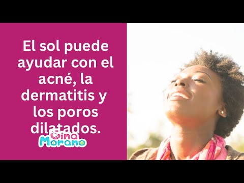 El sol puede ayudar con el acné, la dermatitis y los poros dilatados.