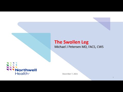 HealthyU webinar series: The swollen leg - when should you worry?