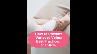 How to Prevent Varicose Veins: Best Practices to Follow