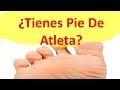 Tienes Pie De Atleta? Cinco Remedios Caseros Para El Pie De Atleta