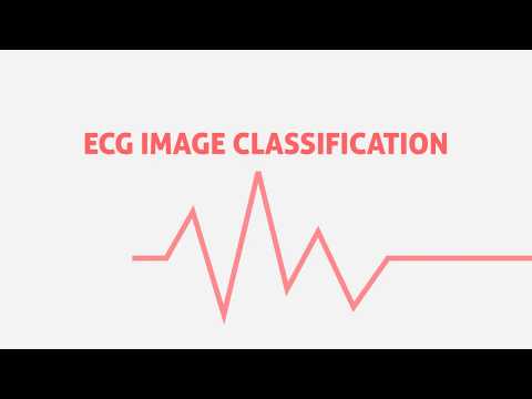 Electrocardiography Hearbeat Classification