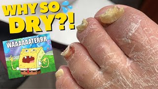 Dry, Crumbly, Flaky Nails and Skin - OH MY