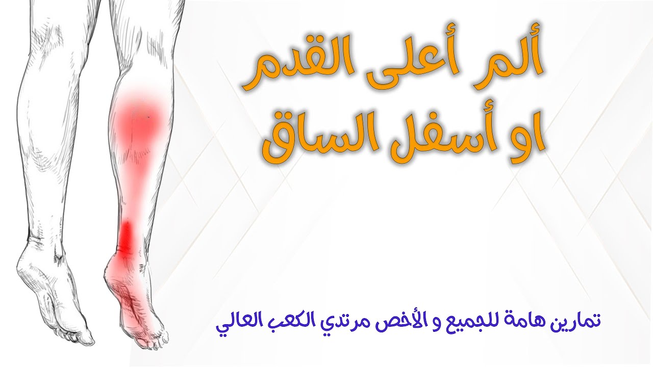 الألم اعلى القدم و اسفل الساق . ألم الرياضين او اصحاب الوقوف الطويل و طبعا مرتديات الكعب العالي