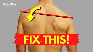 How to Fix a High Shoulder for Good screenshot 4