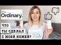 JuLiLi | The Ordinary МОЙ ОПЫТ | НИАЦИНАМИД | АЗЕЛАИНОВАЯ КИСЛОТА | МАСЛО ШИПОВНИКА