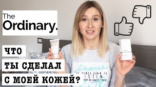 The Ordinary МОЙ ОПЫТ | НИАЦИНАМИД | АЗЕЛАИНОВАЯ КИСЛОТА | МАСЛО ШИПОВНИКА