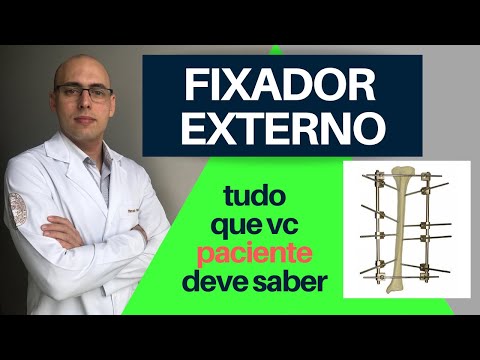 Vídeo: O que é um fixador de casa alta?