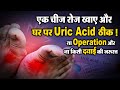        uric acid    d5 channel hindi