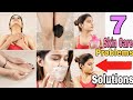 7 Problems - 7 Solutions | Winter Skin Care Special | Skin Care Hacks | Super Style Tips