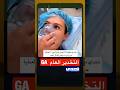 تحدي مقاومة التخدير لفتاة قبل إجراء العملية حيث انها لم تستطع اكمال العد 