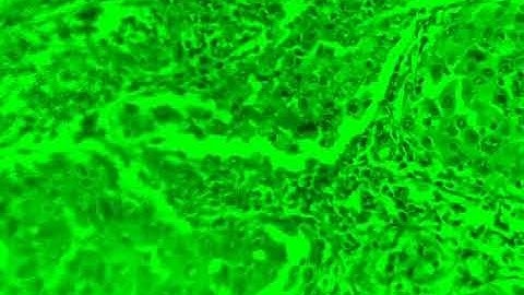 40X Lung cancer video with XY movement from Flexure