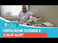 😕 Покраснение головки и белый налет. Клинический случай №898