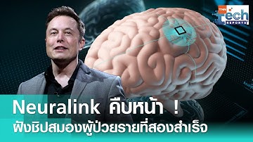 Neuralink เผย ! ปลูกถ่ายชิปในสมองผู้ป่วยรายที่สองเรียบร้อยแล้ว | TNN Tech Reports