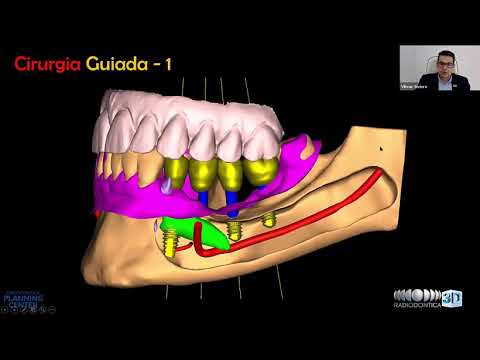 Vídeo: Processamento de vidro: tipos e equipamentos