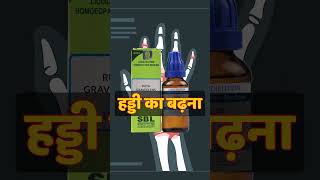 हड्डी बढ़ने का होम्योपैथिक दवा Homeopathy For Bone Spur Resimi