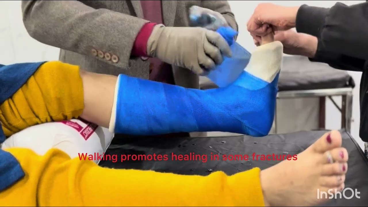 B/K plaster cast # Grace Hospital 