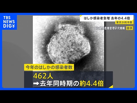 462 Measles Cases Reported; Tokyo Accounts for About Half | TBS