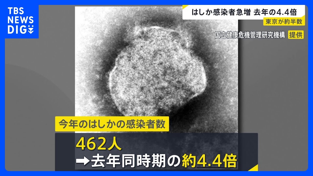 462 Measles Cases Reported; Tokyo Accounts for About Half | TBS