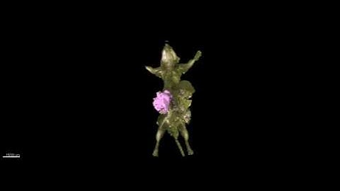 Whole-Body Imaging of Cancer Metastasis (VIDEO)