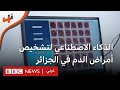 استخدام الذكاء الاصطناعي لتشخيص أمراض الدم في الجزائر