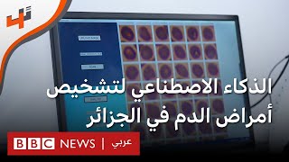 استخدام الذكاء الاصطناعي لتشخيص أمراض الدم في الجزائر