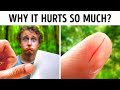 Why Paper Cuts Are So Painful (And Other Surprising Facts)