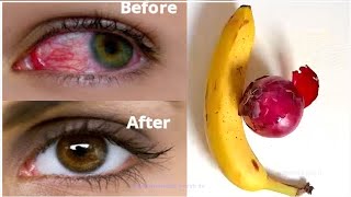 Drink banana and onion to restore eyesight naturally at home in 5 days ! improve bad eyesight fast