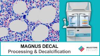 MAGNUS DECAL: Automated Tissue Processor with Integrated Bone Marrow Decalcification