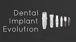 The Dental Implant Evolution | Transitioning from Titanium to Metal-Free Implants