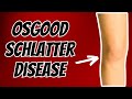 Top 3 Treatments for Osgood Schlatter Disease or Syndrome.