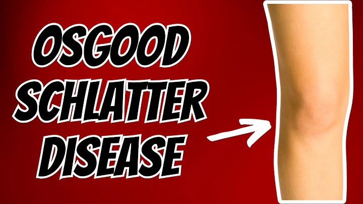 Top 3 Treatments for Osgood Schlatter Disease or S...