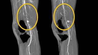 CTA Data Acquisition and Image Post Processing Part 2