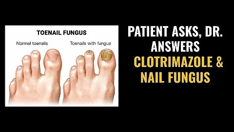 Is Clotrimazole The Best Treatment for Nail Fungus...