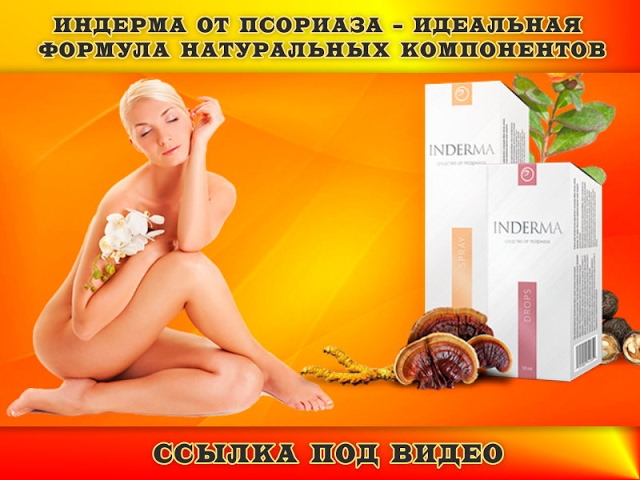 ЛЕЧЕНИЕ ПСОРИАЗА.  ИНДЕРМА