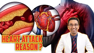 Young heart attacks ? I Medical system is flawed | Dr pal