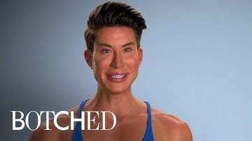 Human Ken Doll Is BACK With MORE Implants | Botched | E!
